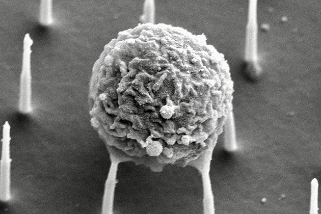 Microscopic image showing an immune cell interacting with a nanostructured surface containing needle-like projections.