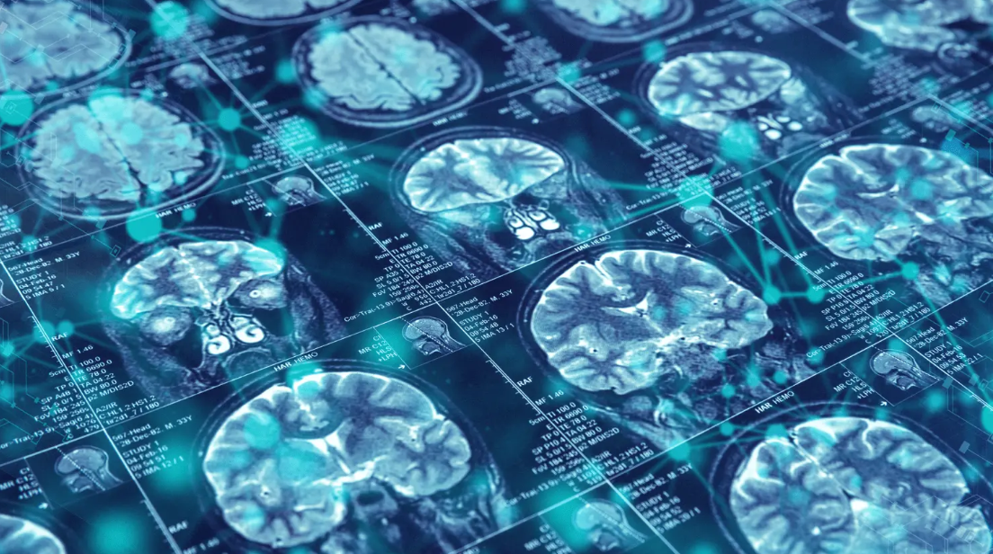 Long before memory loss or confusion appears, Alzheimer's disease may already be causing changes in the brain. These biological changes can go undetected for years, making early identification one of the field's biggest challenges and opportunities.