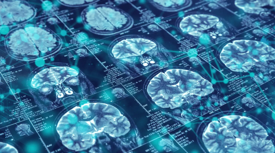 Long before memory loss or confusion appears, Alzheimer's disease may already be causing changes in the brain. These biological changes can go undetected for years, making early identification one of the field's biggest challenges and opportunities.