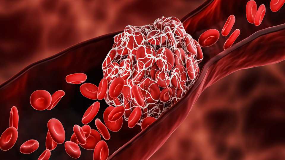 Model of a blood clot