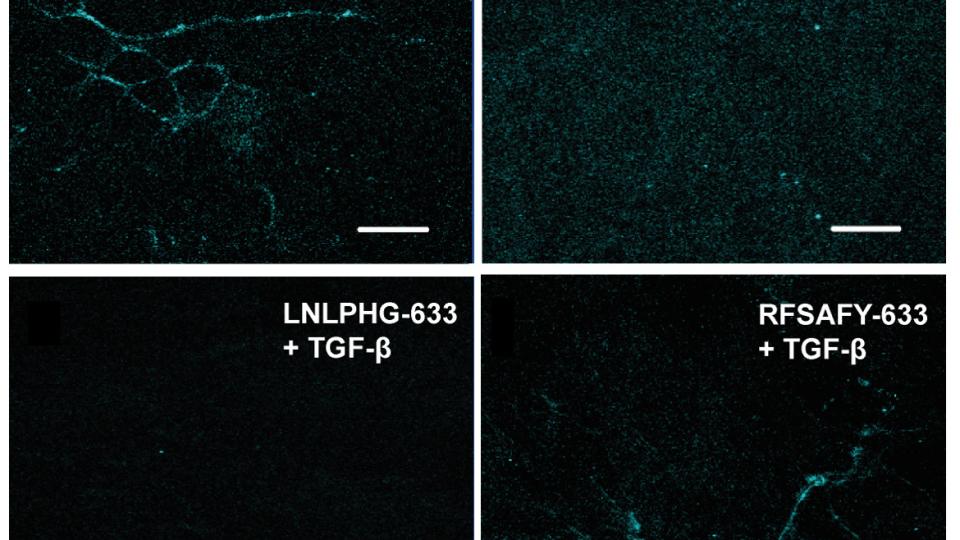Molecular probes fibronectin strain ECM