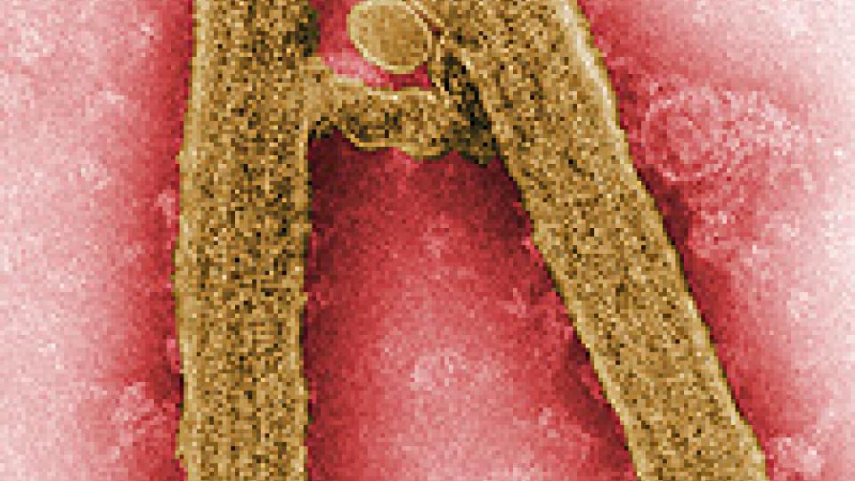 Marburg virus virion