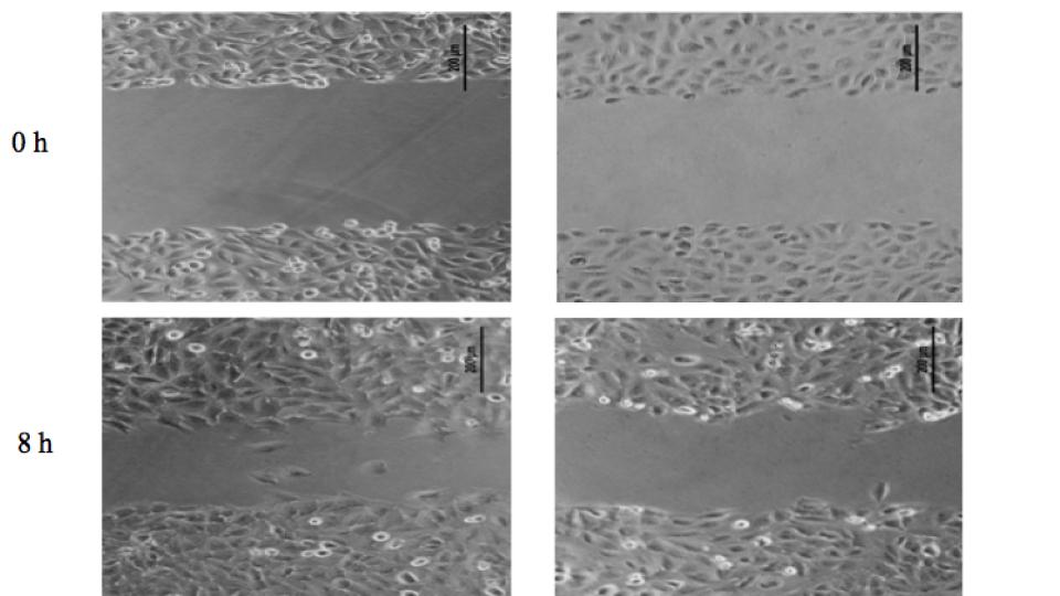 Turning Back the Clock on Ovarian Cancer