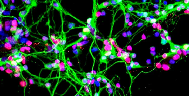 Neurons growing in a culture dish (NASA)