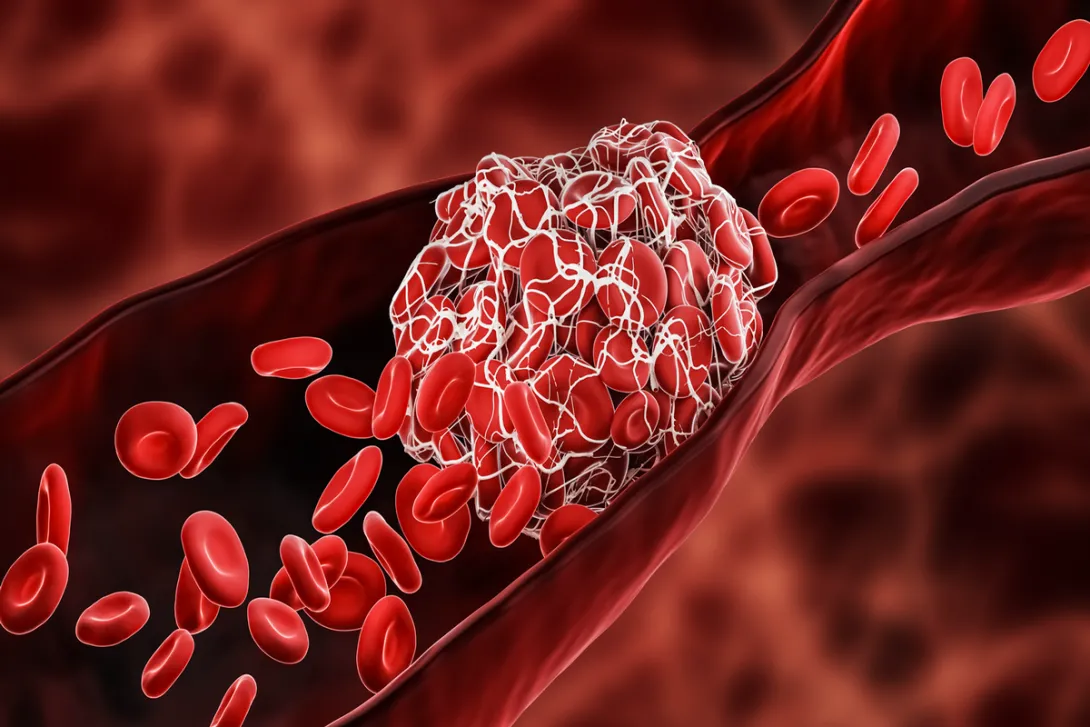 Model of a blood clot