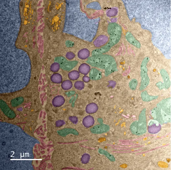 Winner of the NNCI Most Unique Capability category
