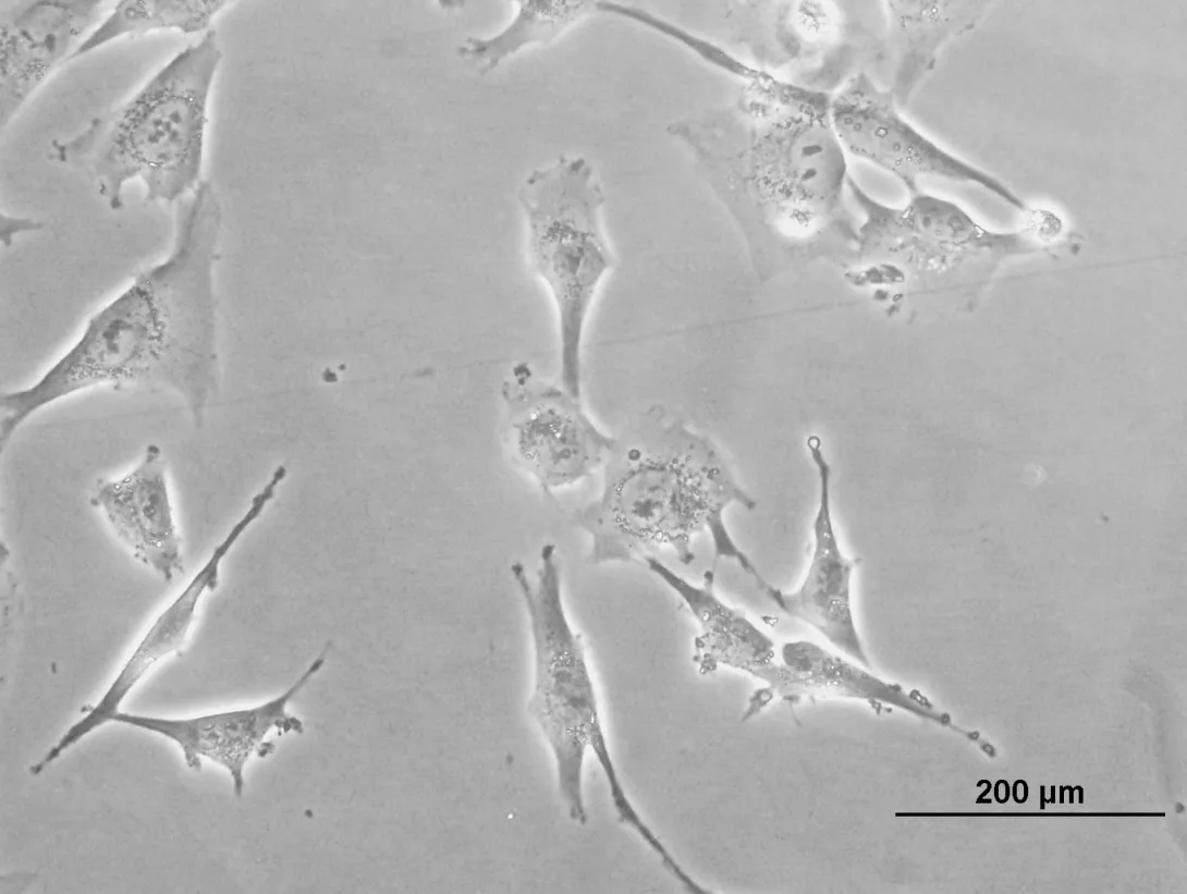 Starting Mesenchymal Cells