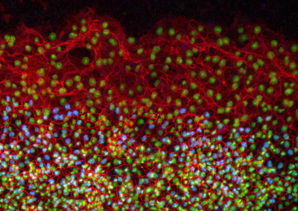BrDU cell proliferation