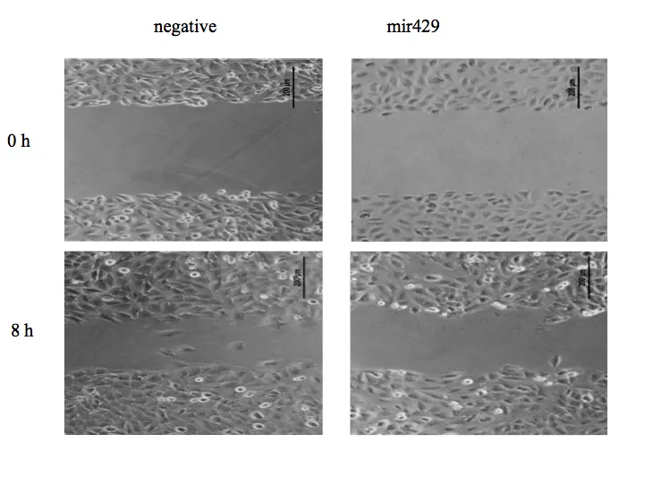 Turning Back the Clock on Ovarian Cancer