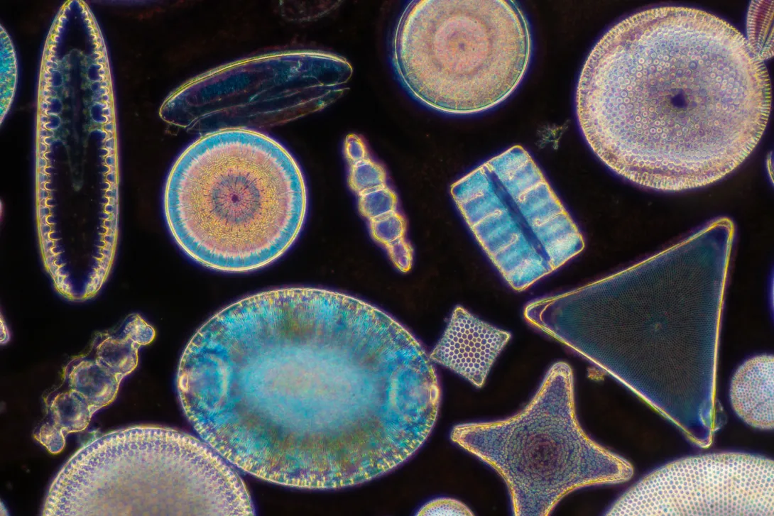 Colorful diatoms under a microscope. 