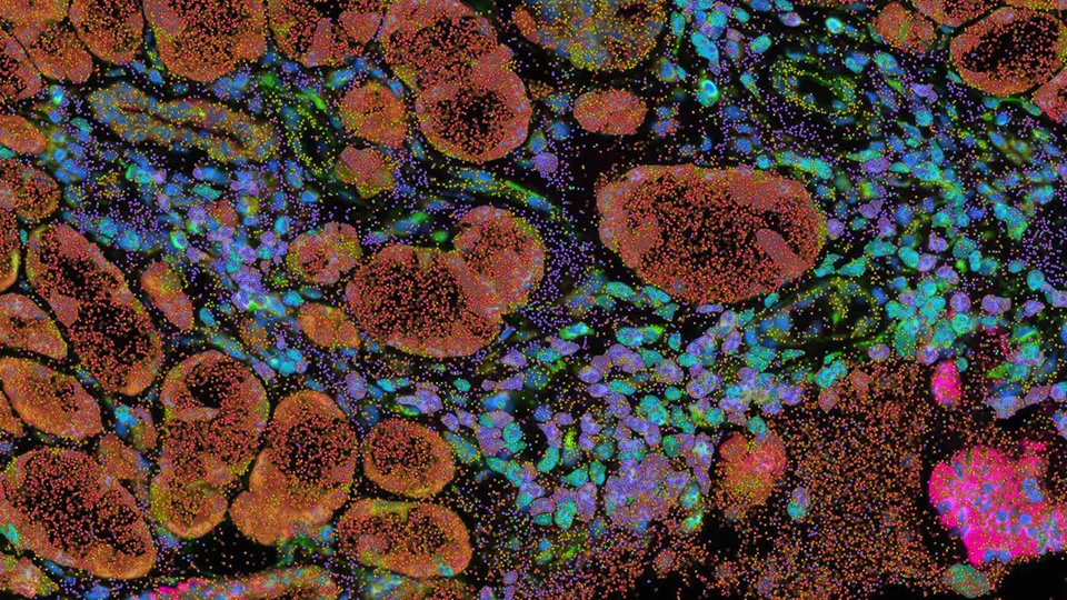 Images of fluorescent cells in orange, blue, purple, pink, and green are shown on a black background. 