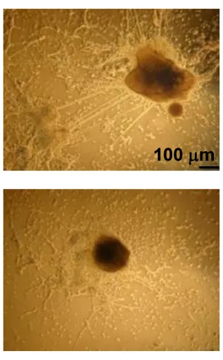 Stem cell neural differentiation impairment
